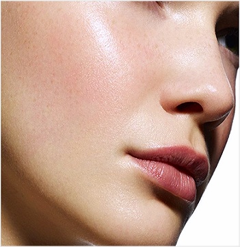 Acne & Scar Revision